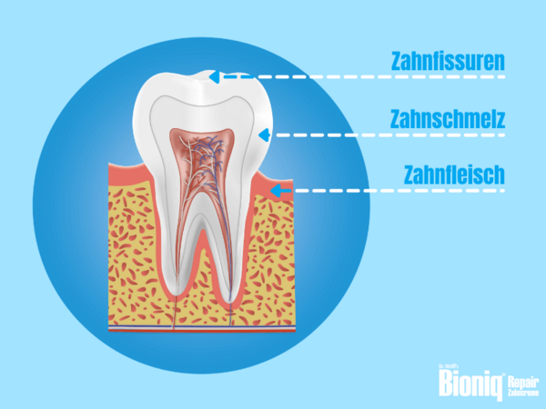 Illustrierter Querschnitt eines Backenzahns mit Zahnfissuren (kleinen Löchern), Zahnschmelz und Zahnfleisch