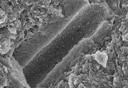 Figure 1: Dentin tubule surrounded by dentin, consisting of organic (mainly collagen) and inorganic (hydroxyapatite) components.